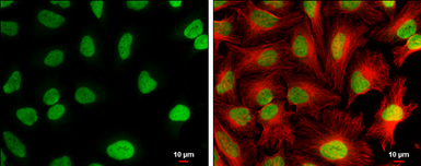 Anti-CFDP1 antibody used in Immunocytochemistry/ Immunofluorescence (ICC/IF). GTX128023