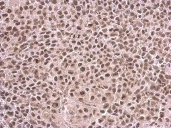 Anti-CFDP1 antibody used in IHC (Paraffin sections) (IHC-P). GTX128023