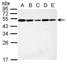 Anti-CFDP1 antibody used in Western Blot (WB). GTX128023