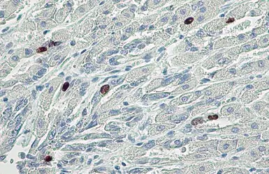 Anti-Histone H3S10ph (phospho Ser10) antibody used in IHC (Paraffin sections) (IHC-P). GTX128116