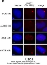 Anti-ATR (phospho Thr1989) antibody used in Immunocytochemistry/ Immunofluorescence (ICC/IF). GTX128145