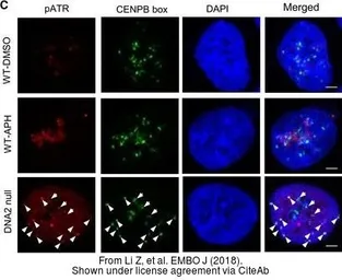 Anti-ATR (phospho Thr1989) antibody used in Immunocytochemistry/ Immunofluorescence (ICC/IF). GTX128145