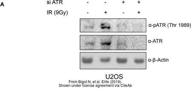 Anti-ATR (phospho Thr1989) antibody used in Western Blot (WB). GTX128145