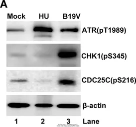 Anti-ATR (phospho Thr1989) antibody used in Western Blot (WB). GTX128145