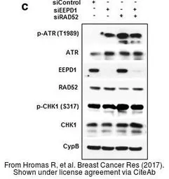 Anti-ATR (phospho Thr1989) antibody used in Western Blot (WB). GTX128145