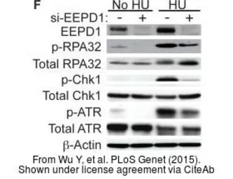 Anti-ATR (phospho Thr1989) antibody used in Western Blot (WB). GTX128145