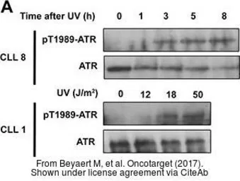 Anti-ATR (phospho Thr1989) antibody used in Western Blot (WB). GTX128145