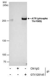 Anti-ATR (phospho Thr1989) antibody used in Immunoprecipitation (IP). GTX128145