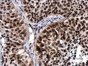 Anti-ATR (phospho Thr1989) antibody used in IHC (Paraffin sections) (IHC-P). GTX128145