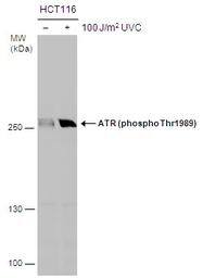 Anti-ATR (phospho Thr1989) antibody used in Western Blot (WB). GTX128145