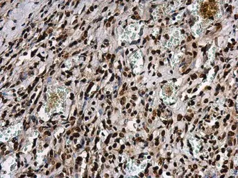 Anti-ATR (phospho Thr1989) antibody used in IHC (Paraffin sections) (IHC-P). GTX128145