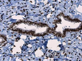 Anti-ATR (phospho Thr1989) antibody used in IHC (Paraffin sections) (IHC-P). GTX128145