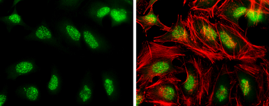 Anti-ATR (phospho Thr1989) antibody used in Immunocytochemistry/ Immunofluorescence (ICC/IF). GTX128145