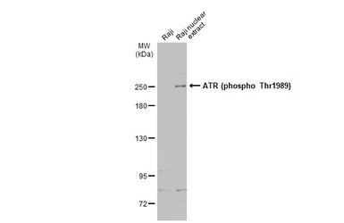 Anti-ATR (phospho Thr1989) antibody used in Western Blot (WB). GTX128145