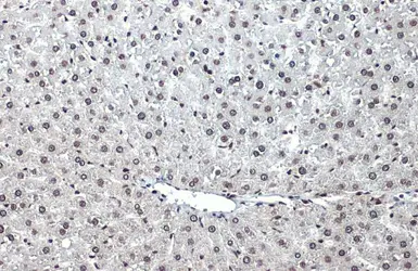 Anti-ATR (phospho Thr1989) antibody used in IHC (Paraffin sections) (IHC-P). GTX128145