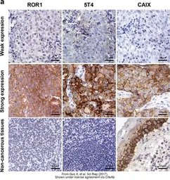 Anti-Carbonic Anhydrase IX antibody used in IHC (Paraffin sections) (IHC-P). GTX128428