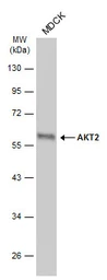 Anti-AKT2 antibody used in Western Blot (WB). GTX128457