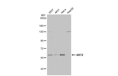 Anti-AKT2 antibody used in Western Blot (WB). GTX128457