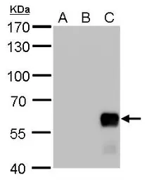 Anti-AKT2 antibody used in Western Blot (WB). GTX128457