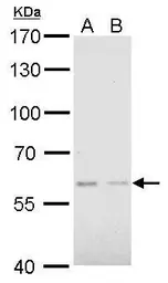 Anti-AKT2 antibody used in Western Blot (WB). GTX128457