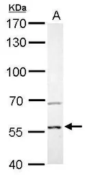 Anti-AKT2 antibody used in Western Blot (WB). GTX128457