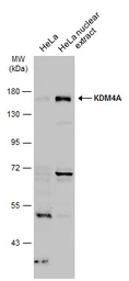 Anti-KDM4A antibody used in Western Blot (WB). GTX128497