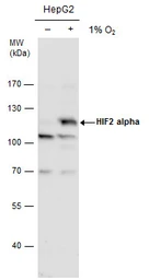 Anti-HIF2 alpha antibody used in Western Blot (WB). GTX128793