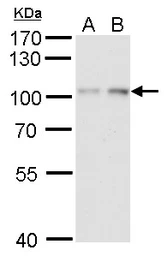 Anti-HIF1 beta antibody used in Western Blot (WB). GTX128795