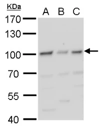 Anti-HIF1 beta antibody used in Western Blot (WB). GTX128795