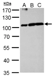 Anti-Aconitase 1 antibody used in Western Blot (WB). GTX128976