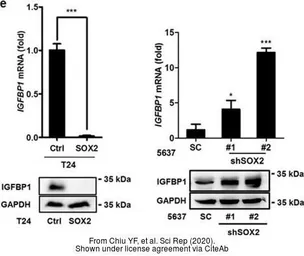 Anti-IGFBP1 antibody used in Western Blot (WB). GTX129006