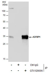 Anti-IGFBP1 antibody used in Immunoprecipitation (IP). GTX129006