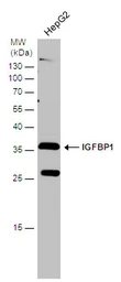 Anti-IGFBP1 antibody used in Western Blot (WB). GTX129006