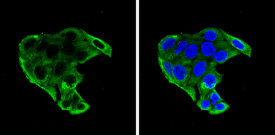 Anti-IGFBP1 antibody used in Immunocytochemistry/ Immunofluorescence (ICC/IF). GTX129006