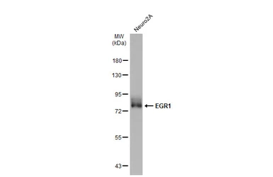 Anti-EGR1 antibody used in Western Blot (WB). GTX129015