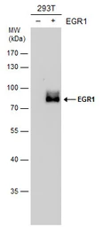 Anti-EGR1 antibody used in Western Blot (WB). GTX129015