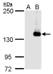 Anti-JARID2 antibody used in Western Blot (WB). GTX129019