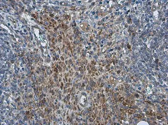 Anti-PRRS virus M protein antibody used in IHC (Paraffin sections) (IHC-P). GTX129063