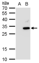 Anti-ATG10 antibody used in Western Blot (WB). GTX129097