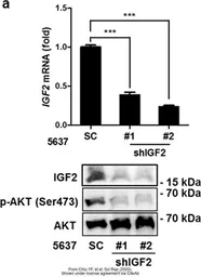 Anti-IGF2 antibody used in Western Blot (WB). GTX129110