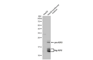 Anti-IGF2 antibody used in Western Blot (WB). GTX129110