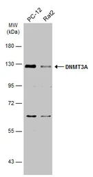 Anti-DNMT3A antibody used in Western Blot (WB). GTX129125