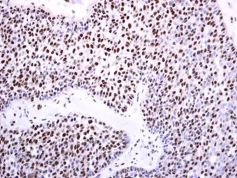 Anti-DNMT3B antibody used in IHC (Paraffin sections) (IHC-P). GTX129127