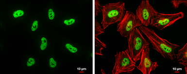 Anti-DNMT3B antibody used in Immunocytochemistry/ Immunofluorescence (ICC/IF). GTX129127