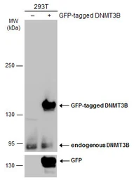 Anti-DNMT3B antibody used in Western Blot (WB). GTX129127