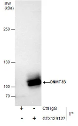 Anti-DNMT3B antibody used in Immunoprecipitation (IP). GTX129127