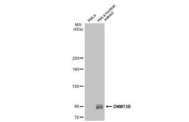 Anti-DNMT3B antibody used in Western Blot (WB). GTX129127