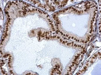 Anti-SIN3A antibody used in IHC (Paraffin sections) (IHC-P). GTX129156