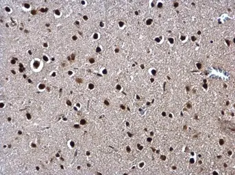 Anti-SIN3A antibody used in IHC (Paraffin sections) (IHC-P). GTX129156