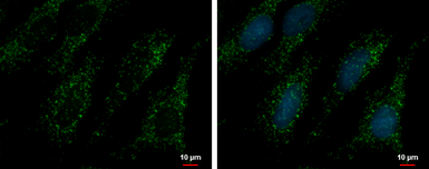 Anti-PEX14 antibody used in Immunocytochemistry/ Immunofluorescence (ICC/IF). GTX129230